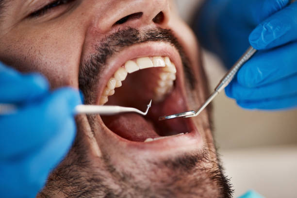 Best Urgent Tooth Repair  in Meridian Hills, IN
